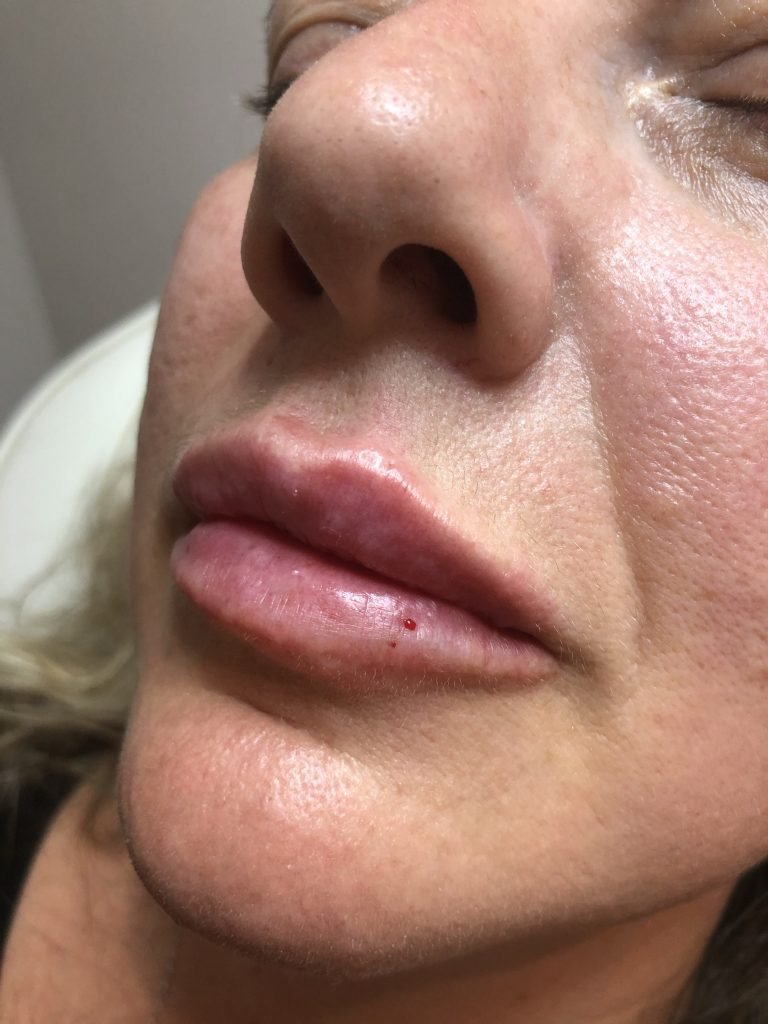 A for Aesthetics — genuine patient before and after